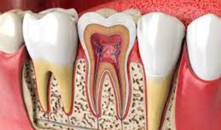 Enhance Your Oral Health With Root Canal Therapy