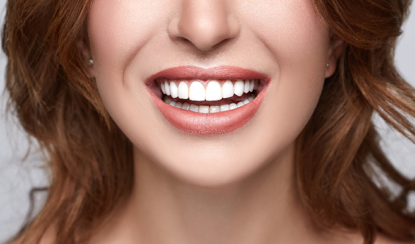 5 Amazing Ways Veneers Can Improve Your Smile