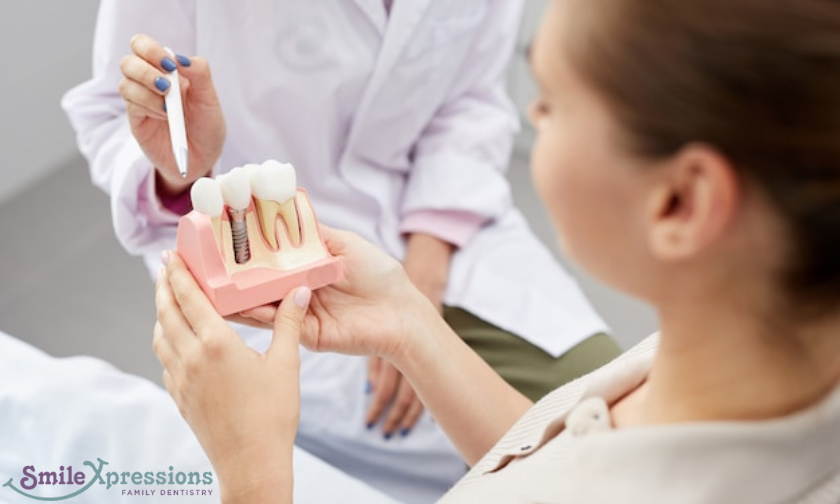 Why You Should Consider Getting Dental Implants