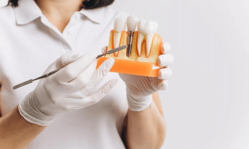 Dental Implants in Artesia