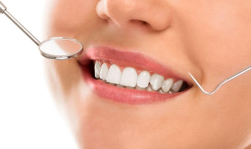 Benefits Of Teeth Whitening: A Confident Smile And More