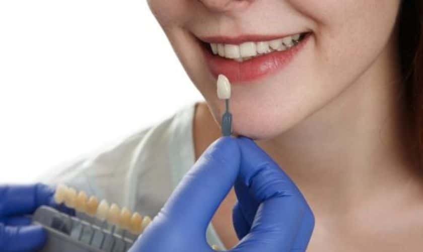 How To Know If You Need A Cosmetic Dentist?