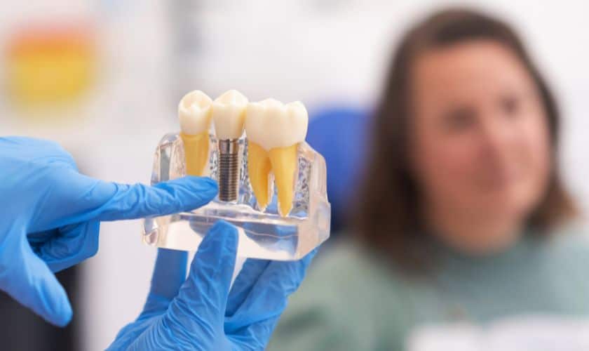 Dental Implants in Artesia