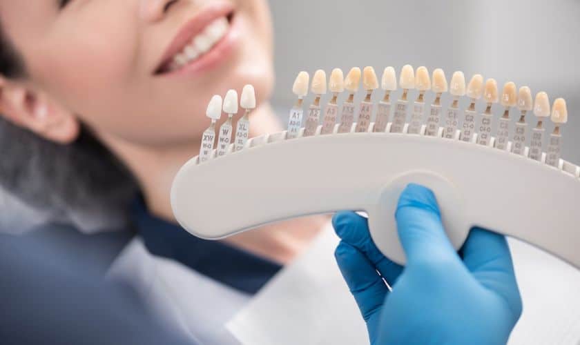 Dental Veneers Artesia