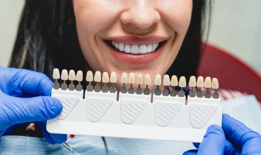 Teeth Whitening in Artesia