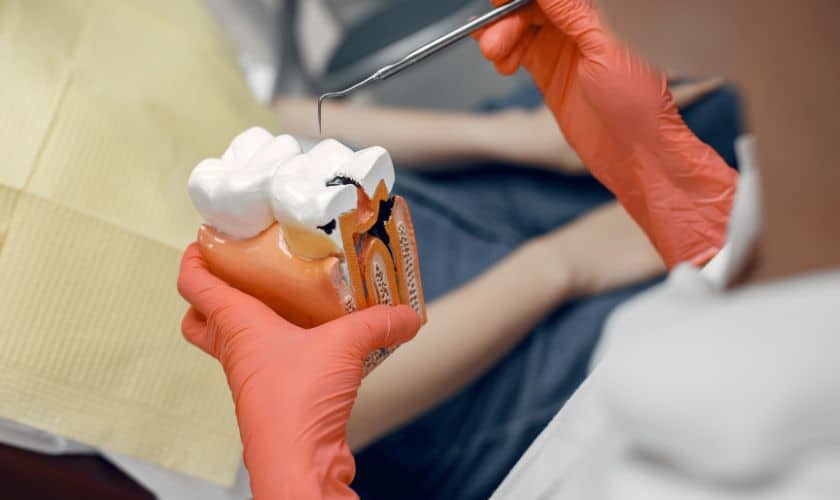 Root Canal Therapy in Artesia