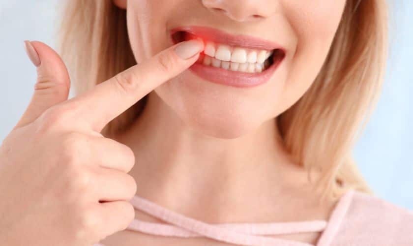 Periodontal Disease Treatment Artesia