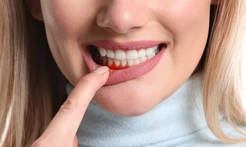 Periodontal Disease Treatment Artesia