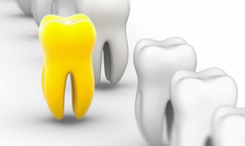 How can I make my yellow teeth whiter naturally?