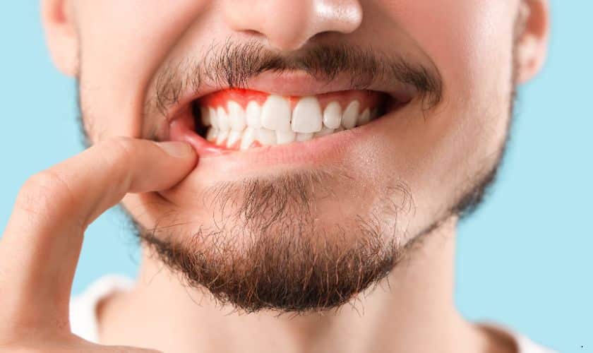 Is It Ever Too Late To Reverse Gum Disease