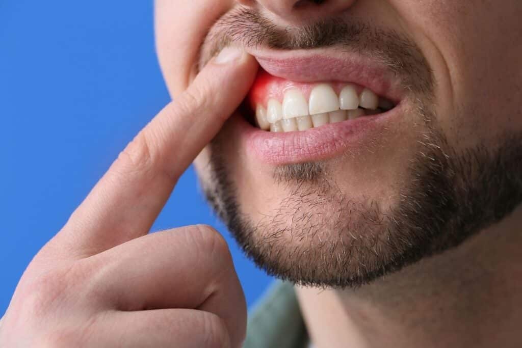 will i lose my teeth if i have periodontal disease