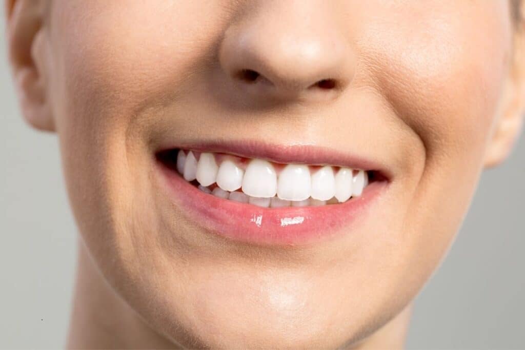 How long does whitening at the dentist take?