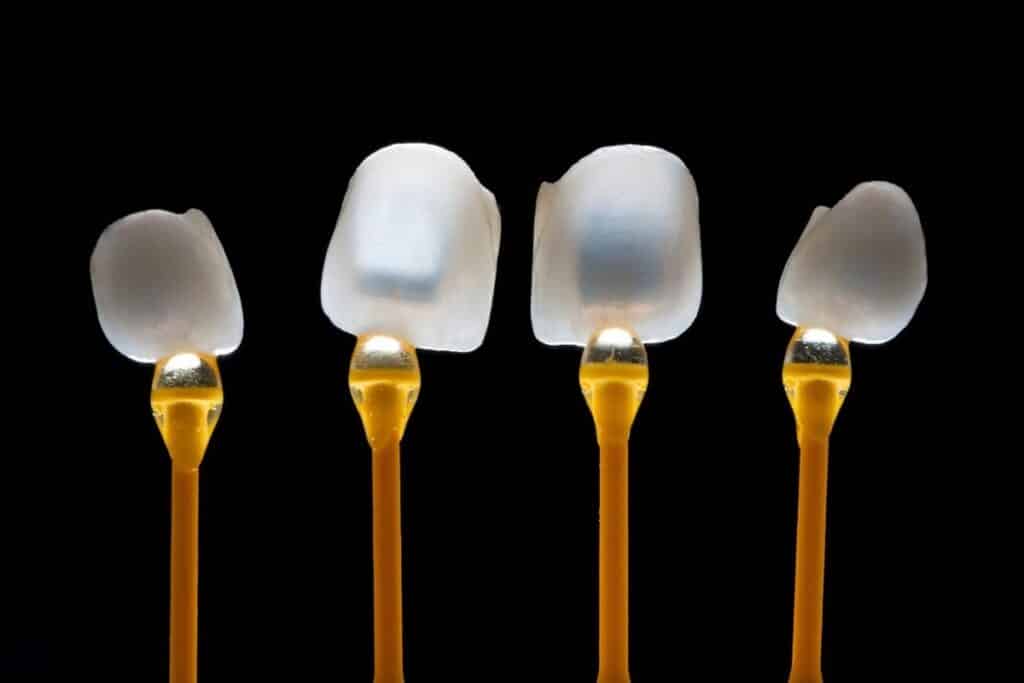 Dental Crowns Artesia