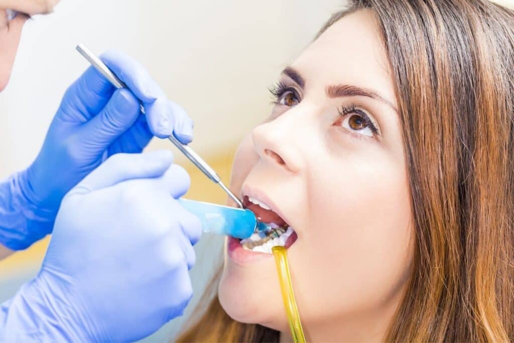 what type of filling is best for teeth