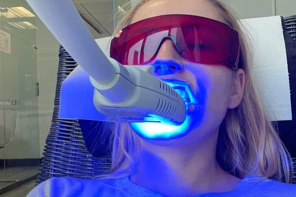 Teeth Whitening Artesia