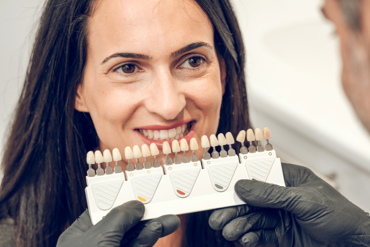 Modern Veneers