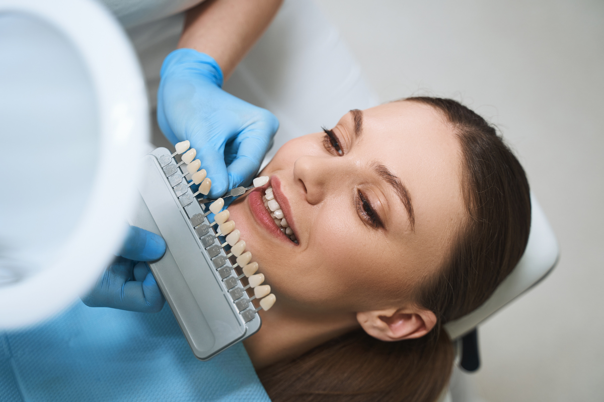 Veneers