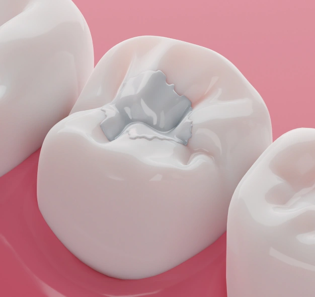 Restoring Your Smile Naturally