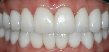 cosmetic dentistry after