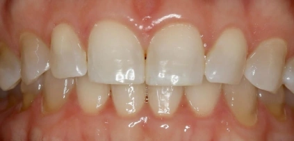 cosmetic dentistry before